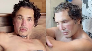 «Жалкий тип в употреблении»: Нарколог объяснил, что случилось с лицом сбежавшего в США Рустама Солнцева*