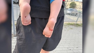 Стёкла врезались в ножки: Годовалый малыш пострадал из-за налёта дронов ВСУ на Воронеж