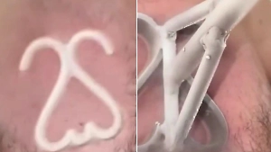 Люди начали испытывать на себе метод клеймения, используемый для животных