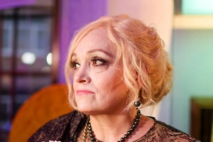 Первым худеет лицо: Врач объяснил тревожные изменения во внешности Кадышевой