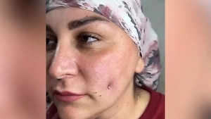 Бьюти-тренд на Кавказе: Девушки массово стали делать себе небольшую изюминку на лице