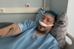 «Хочу, как у Майкла Джексона»: Артемий Лебедев показал фото после пластики носа