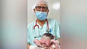 «Держа трофей»: В Бразилии новорождённый появился на свет с внутриматочной спиралью в руке