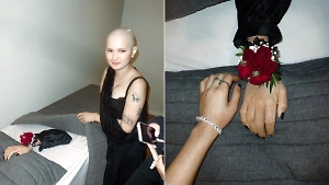 Американка устроила похороны руки, ампутированной из-за онкологии