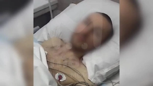 Петербуржец решил сменить пол на дому и вырезал себе яички кухонным ножом