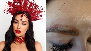 Модели выжгли брови во время сеанса по удалению татуажа в Уфе