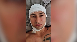 «Должен был в течение двух недель»: Известному российскому рэперу удалили опухоль в мозге