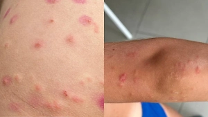 Пляжи Таиланда захватил таинственный планктон, который жалит туристов даже через одежду