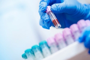 Россиян предупредили о заболевании, которое может стать причиной анемии