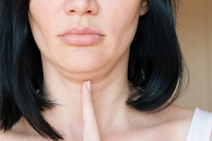 Life.ru выяснил, помогает ли бандаж при втором подбородке