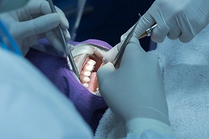 Пациенту по ошибке удалили зубы вместо опухоли в одной из больниц Барнаула