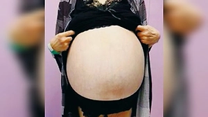 У женщины, которая долго не ходила к гинекологу, выросла 30-килограммовая опухоль