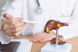 Врач заявила о «буме» цирроза в России. В чём коварство этой болезни и кто в группе риска — карточки Life.ru