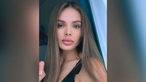 Забыла сына и родителей: Избитая в Москве модель чуть не сбежала из клиники после трепанаций