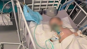 В Оренбурге 10-месячная малышка проглотила гелевые шарики и попала в реанимацию