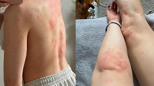 Москвичка попала в больницу с аллергией и потеряла сознание после чашки чая из «Вкусвилла»