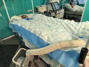 Пермские врачи спасли девочку-подростка, потерявшую 95% кожи из-за редчайшего недуга