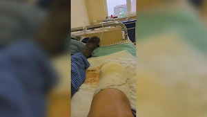 Российский чиновник лишился ноги после ранения на СВО