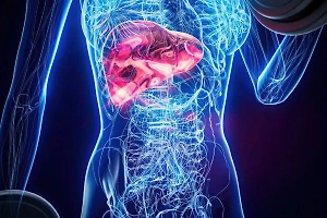 От отёков до снижения либидо: Врач перечислила неочевидные симптомы фиброза печени