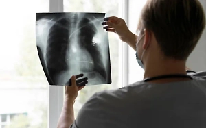 Названы профессии, представители которых сильно рискуют подхватить туберкулёз