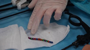 Пробили кишечник: Годовалая малышка из Иркутской области едва не погибла, проглотив магнитные шарики