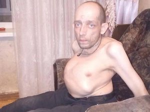 В Подмосковье умер освободившийся из тюрьмы русский «Стивен Хокинг»