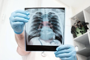 Палочка Коха не дремлет: Как один плевок на улице может привести к туберкулёзу