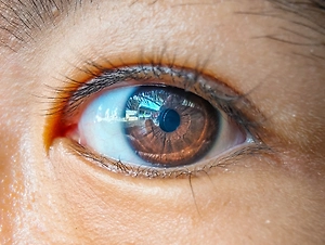 Вирус морских животных добрался до людей и ведёт к слепоте: пациентов уже 70