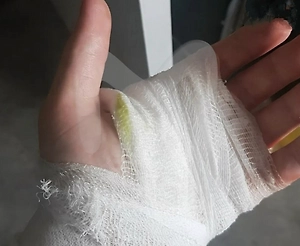 Химловушка «Кукла» взорвалась в руках у школьника в Перми