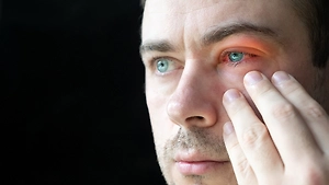 Дверь для инфекции: Офтальмолог рассказал, почему весной опасно тереть глаза и как нельзя лечить ячмень