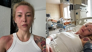 «Пятна начали сходить»: Екатерина Запашная приходит в себя после жуткого приступа аллергии в Крыму