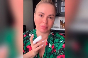 Анна Семенович попала в травмпункт из-за повреждения пальца