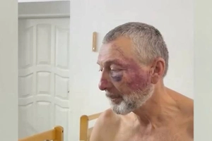 На Украине сотрудники ТЦК избили 61-летнего ветерана войны в Афганистане