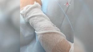 Кость из ноги — в руку: В Рязани провели уникальную операцию раненому бойцу ВС РФ