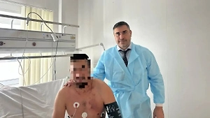 Глава Минздрава Алтая Хубезов показал фото морпеха, выжившего после удара молнии