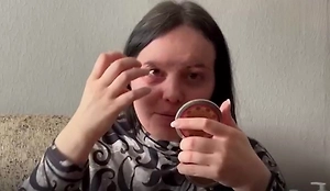 «Не могу нормально спать 2 года»: как нападение «кислотного маньяка» сломало жизнь и карьеру девушки
