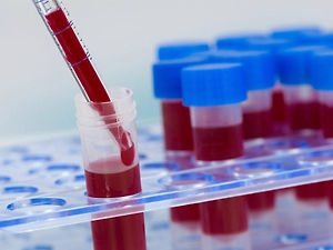 Иностранцев в России начнут проверять на гепатиты B, C и D