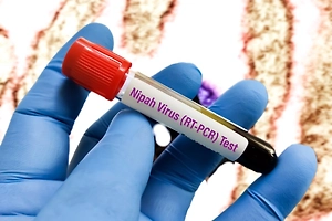 Роспотребнадзор ​дал рекомендации туристам после вспышки вируса Нипах в Индии