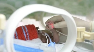 В Уфе врачи спасли жизнь новорожденной малышки весом 480 граммов