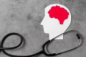 Названы главные факторы риска «помолодевшего» инсульта