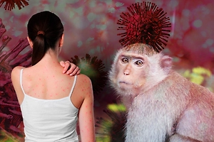 Оспа обезьян (Mpox) в 2026 году: симптомы, передача, лечение и профилактика после случая в Домодедове
