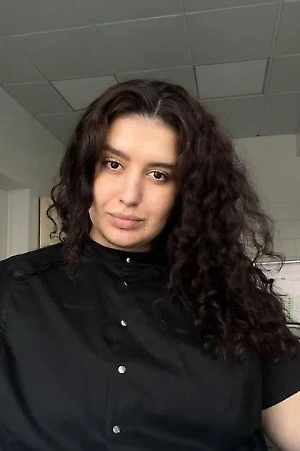 Лицо становится тяжёлым и отёчным, теряется индивидуальность внешности. Парадоксально, но чрезмерная коррекция губ, скул или подбородка нередко добавляет возраст за счёт перегруженности тканей и появления лишних складок.