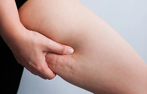 Эконом-спа на дому: Как простая картошка избавит от «апельсиновой корки» к лету