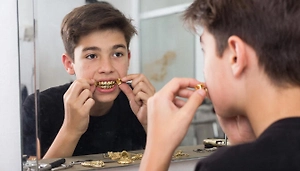 Мода или сигнал тревоги: Психолог объяснила, почему зумеры меняют здоровые зубы на виниры и гриллзы