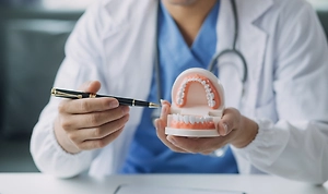 Зубы не прижились? Учёные нашли простой способ гарантировать успех имплантации на 97%