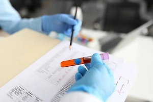 Россиянам назвали анализы, за которыми нужно следить помимо «общей крови»