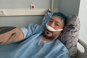 «Хочу, как у Майкла Джексона»: Артемий Лебедев показал фото после пластики носа