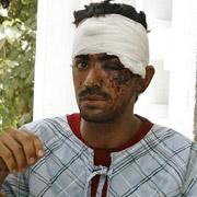 77 раненым продолжают оказывать медицинскую помощь