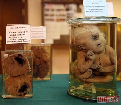 Депутатам наглядно продемонстрировали последствия от употребления наркотиков