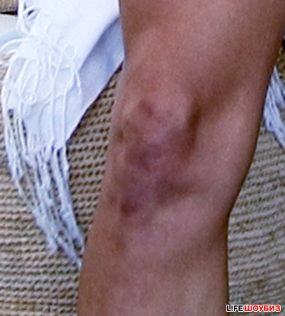 В украинскую столицу секс-бомба прибыла с разбитыми коленками